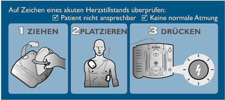 Defibrillator Kurzanleitung | © Ortsgemeinde Spay Defibrillator Kurzanleitung | © Ortsgemeinde Spay